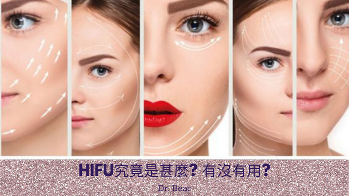 Dr.Bear談HIFU: HIFU究竟是甚麼? 有沒有用?