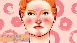 Dr. Bear談皮膚:患上脂溢性皮炎, 要如何處理? BeautyAcademyHK.com/blog